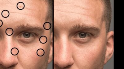How to find and remove blemishes in Photoshop